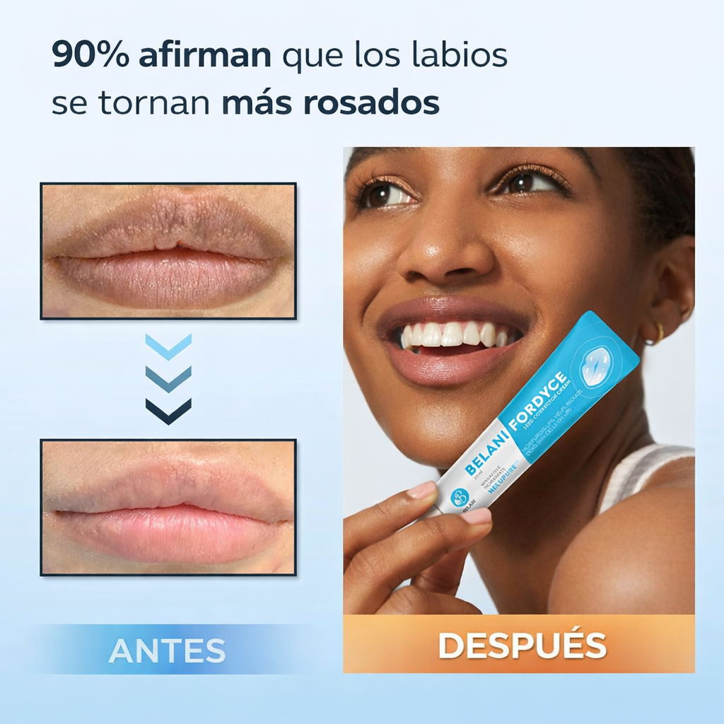 BELANI LipClear™ – Elimina el acné labial y Labios Oscuros